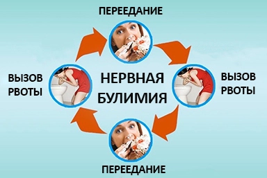 Лечение булимии в Первоуральске